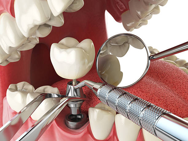 Best Emergency Broken Tooth Repair in East Point, GA