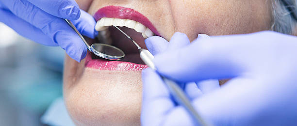 Best Emergency Tooth Extraction in East Point, GA
